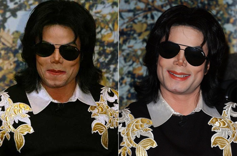 Khuon mat Michael Jackson bi pha hong the nao sau dao keo-Hinh-7